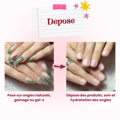 Dépose