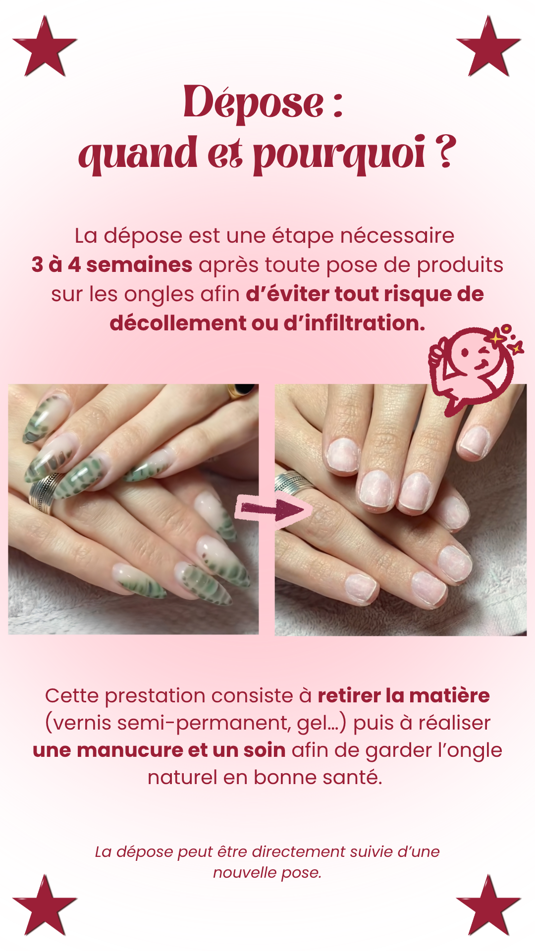 Dépose