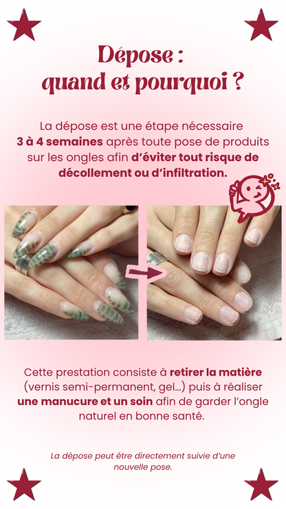 Dépose